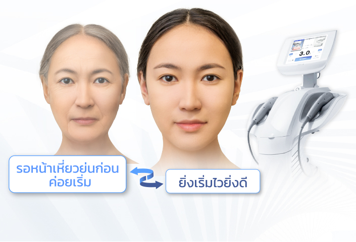 v square clinic ใช้ hifu ultraformer iii