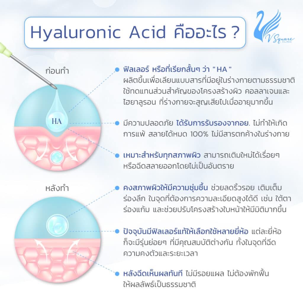 Hyaluronic Acid  HA