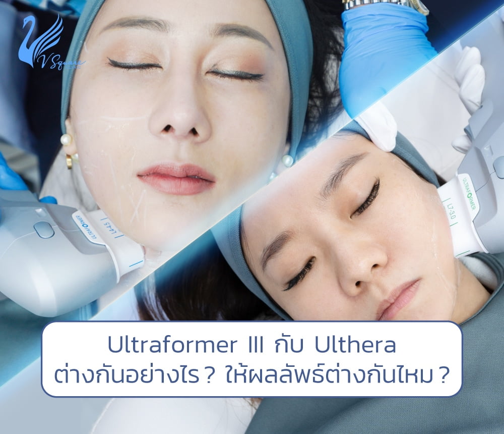 Ultraformer III กับ Ulthera