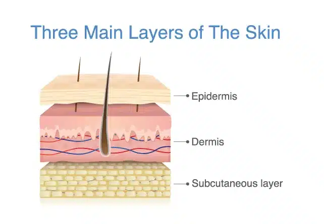 skin layer