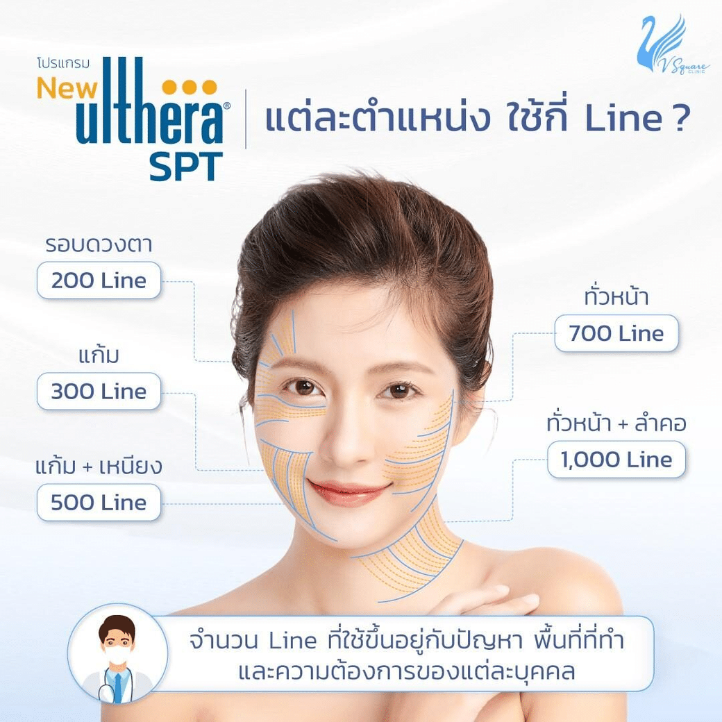 ทำ Ulthera แต่ละตำแหน่งใช้กี่ line