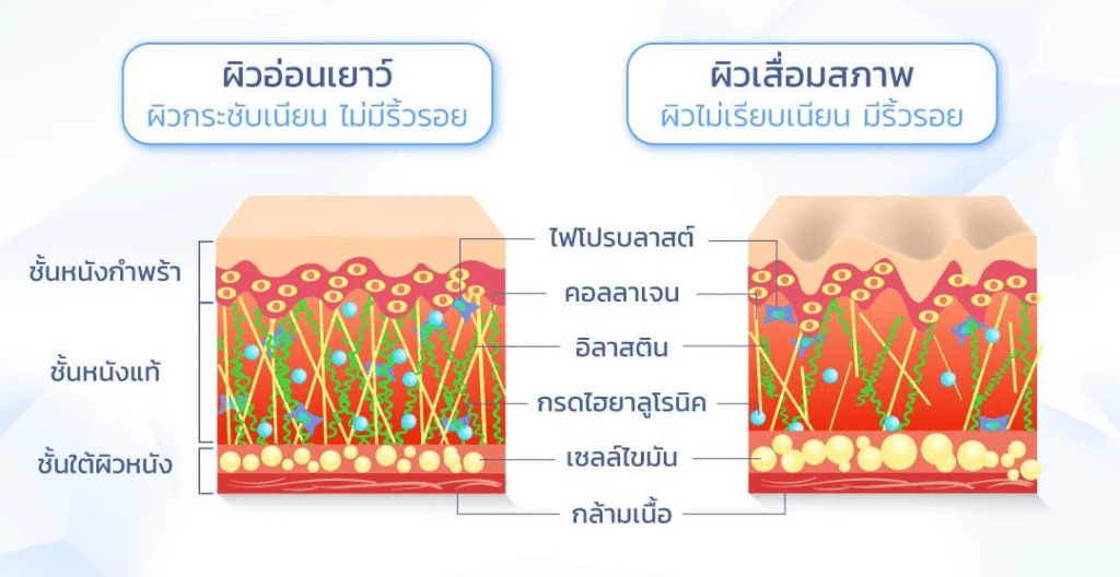 กรดไฮยาลูโรนิก