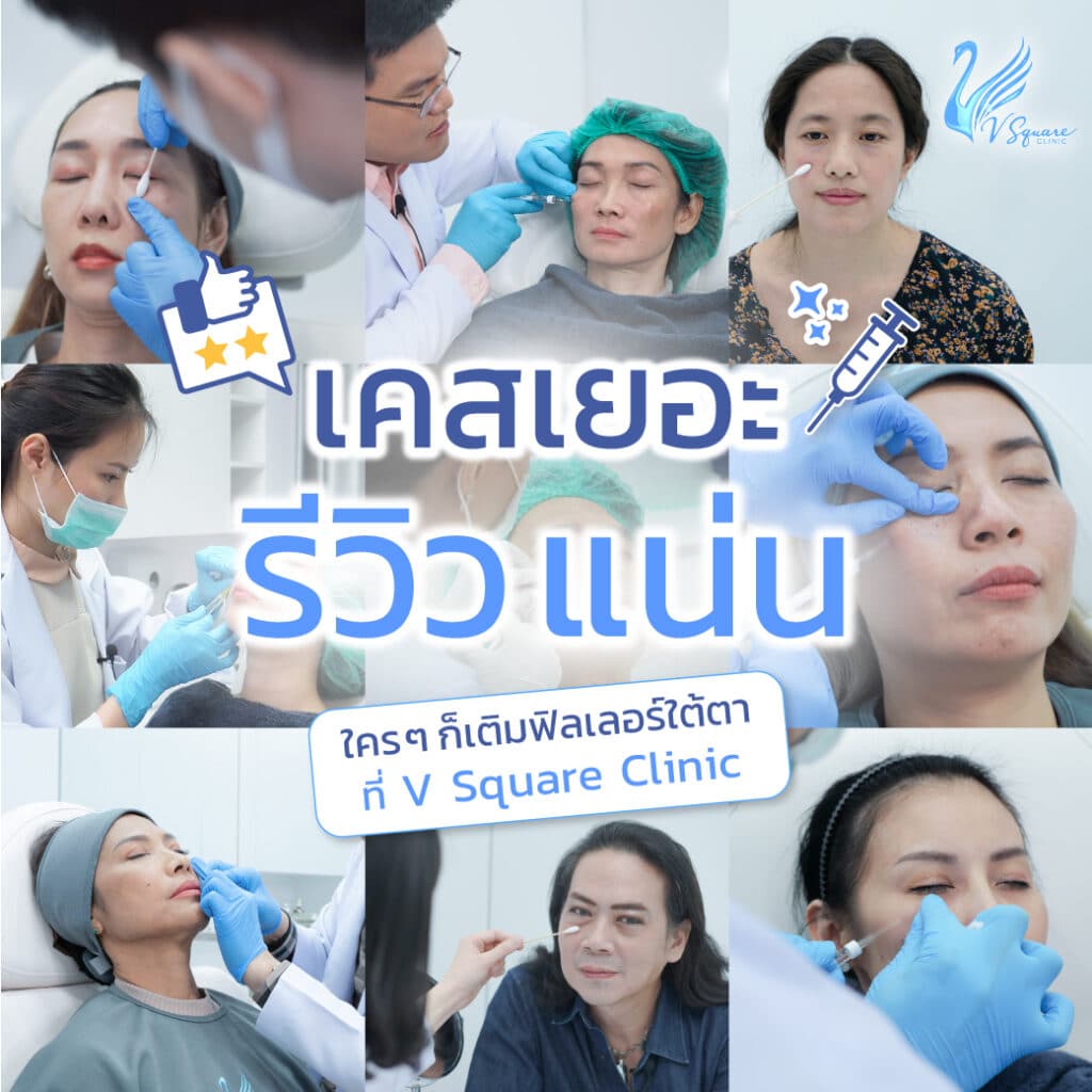 ฉีดฟิลเลอร์ใต้ตากับทีมหมอจาก V Square Clinic ดีอย่างไร _(1)