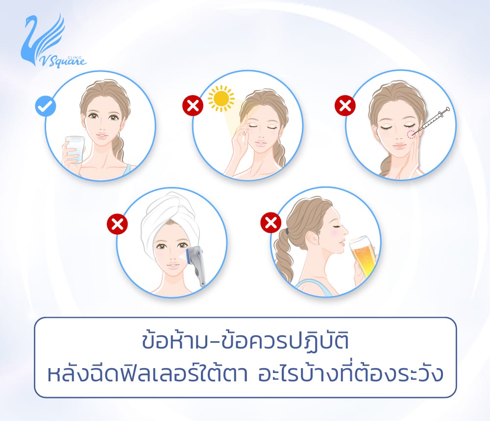 ข้อห้าม-ข้อปฏิบัติหลังฉีดฟิลเลอร์ใต้ตา