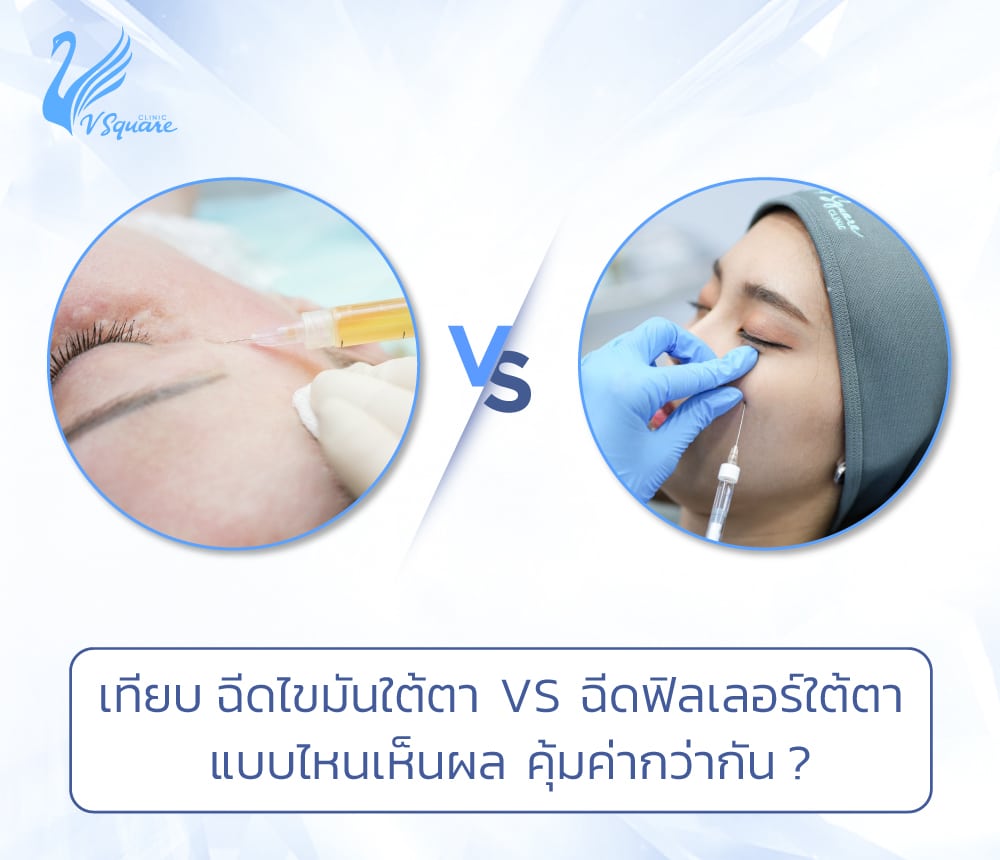 ฉีดไขมันใต้ตา VS ฉีดฟิลเลอร์ใต้ตา