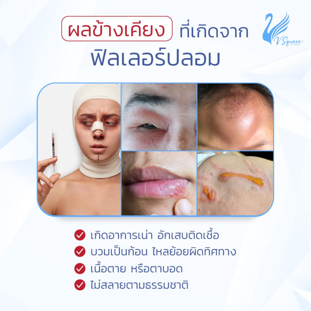 โทษ และอันตรายจากการใช้ฟิลเลอร์ปลอม