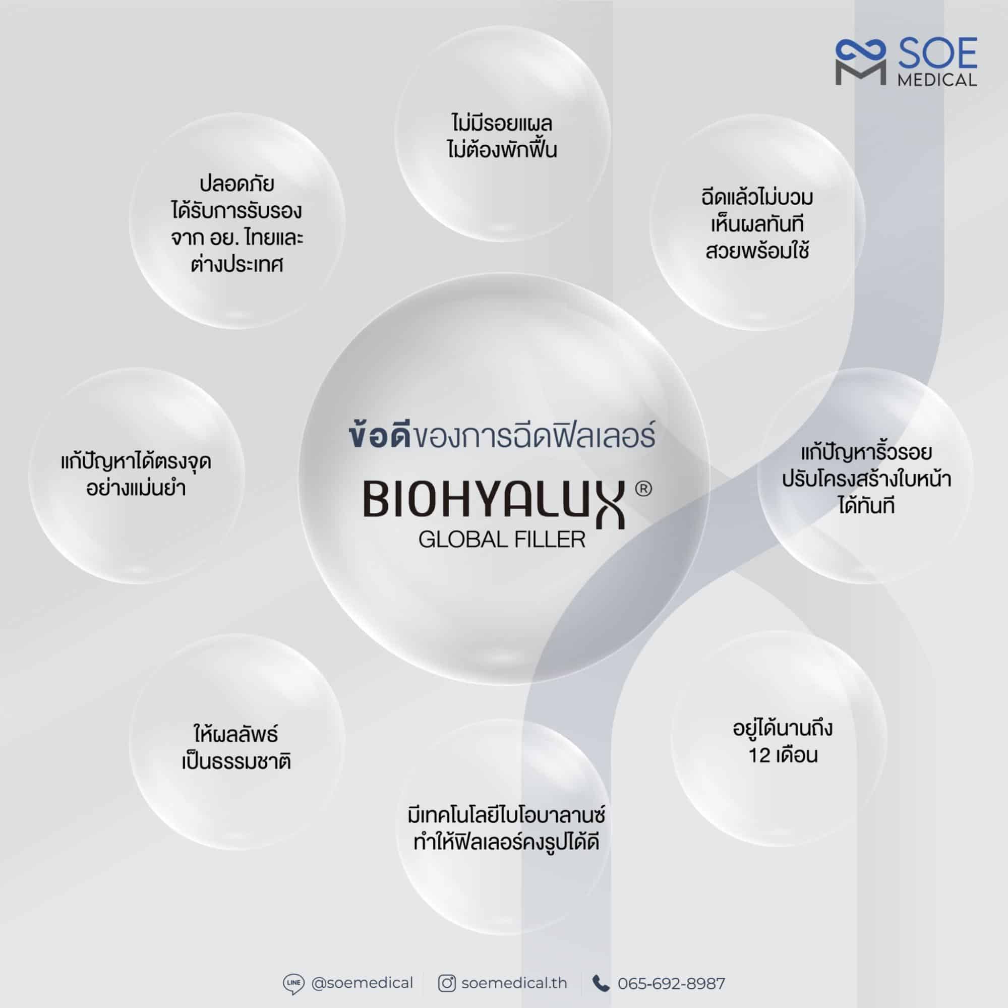 ข้อดีของฟิลเลอร์ Biohyalux