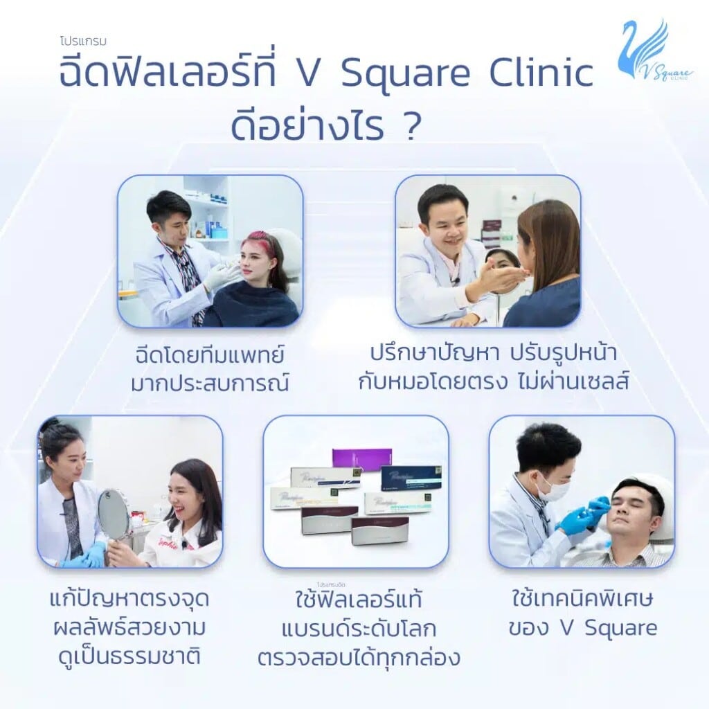 ฉีดฟิลเลอร์แก้มตอบที่ V Square Clinic ดีอย่างไร คุณเจสซี่ โดยหมอโต้ง หมอเอก หมอแพร หมอบาส