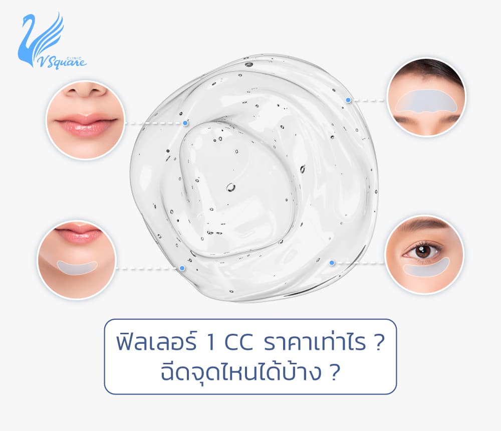 ฟิลเลอร์ 1 CC