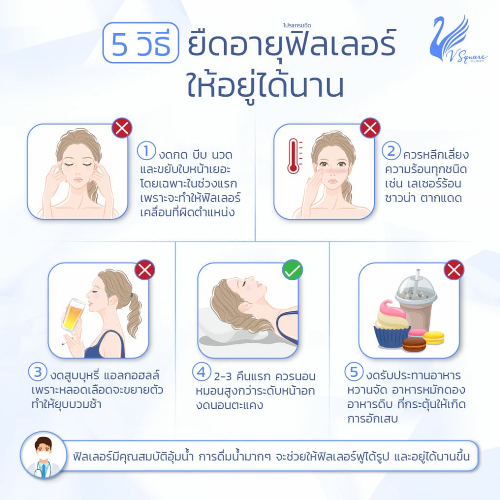 วิธียืดอายุฟิลเลอร์ให้อยู่ได้นาน