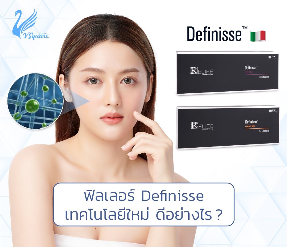 ฟิลเลอร์ Definisse