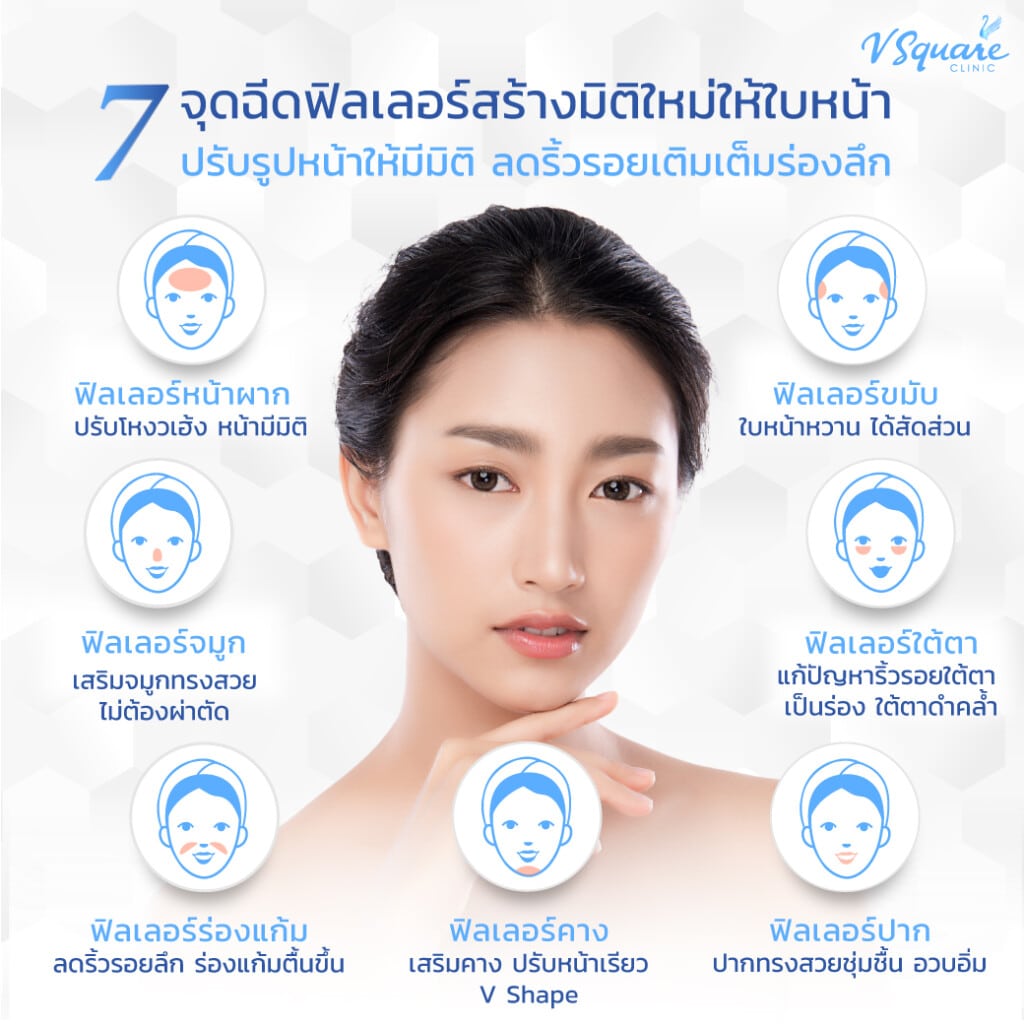 7จุดฉีดฟิลเลอร์