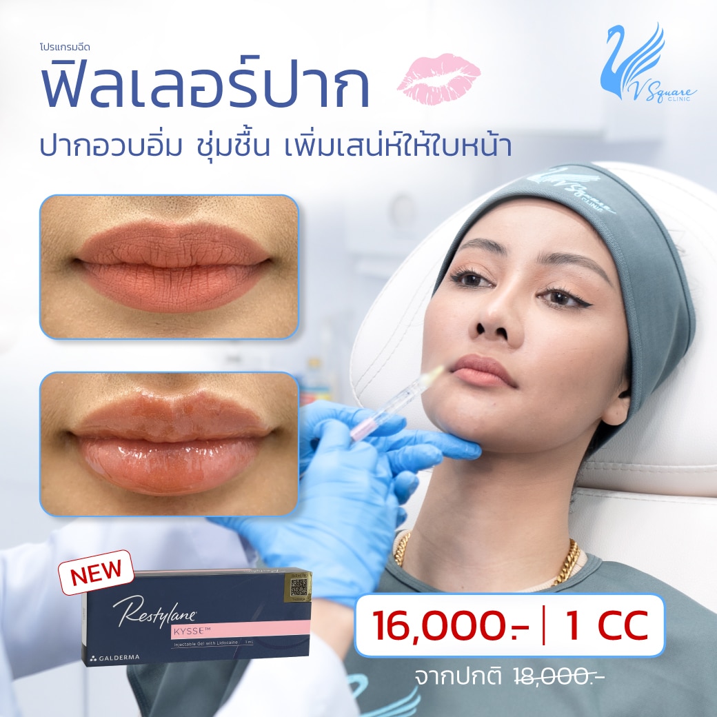 Restylane Kysse ราคาเท่าไร