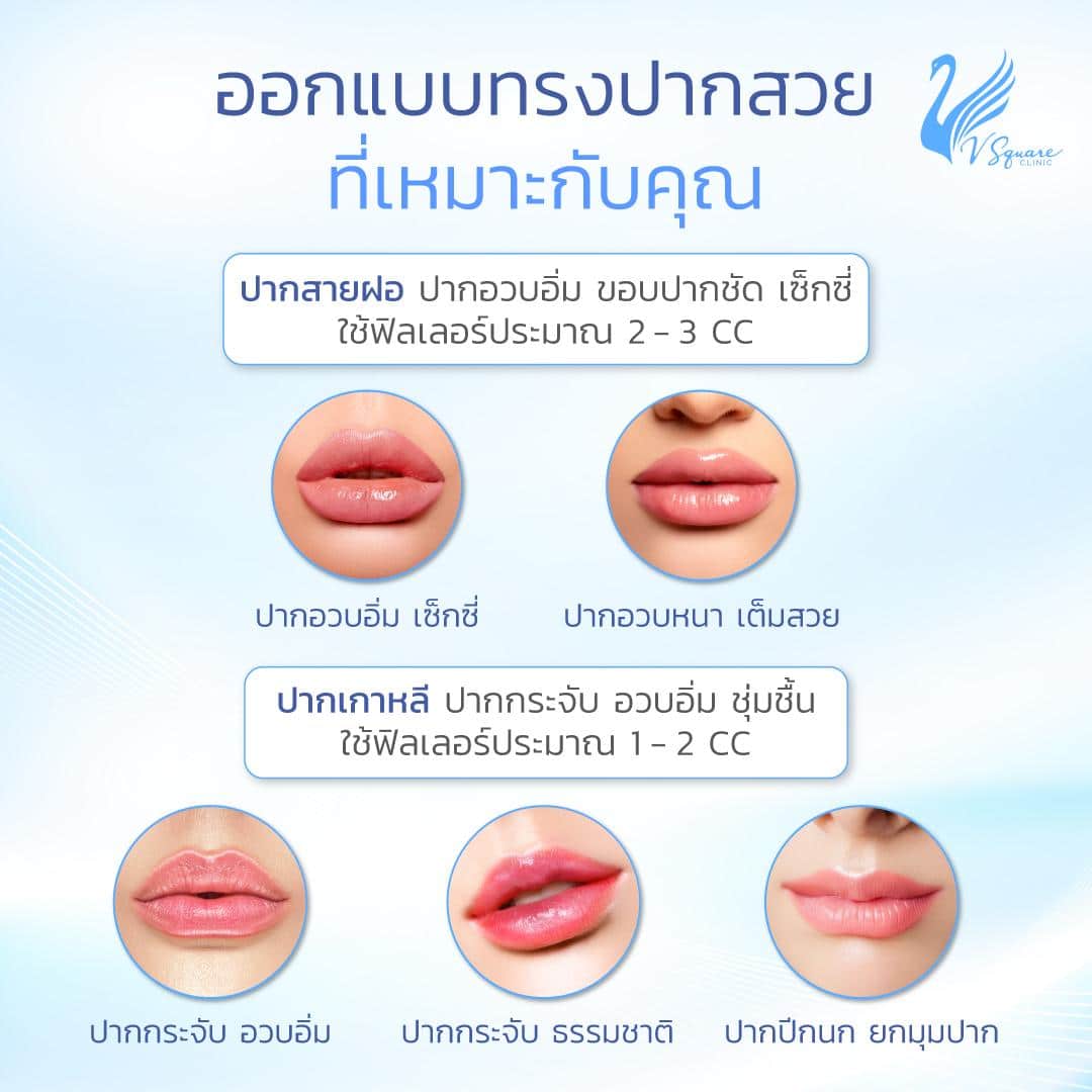 ฉีดฟิลเลอร์ Restylane Kysse ใช้กี่ CC