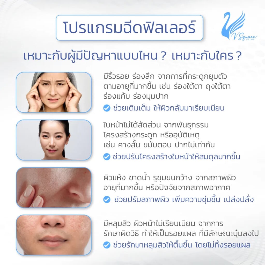 ฟิลเลอร์ Juvederm เหมาะกับใคร