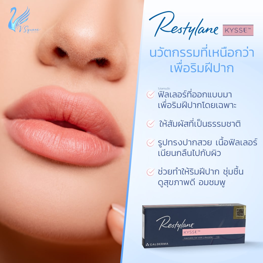 ฟิลเลอร์ Restylane Kysse