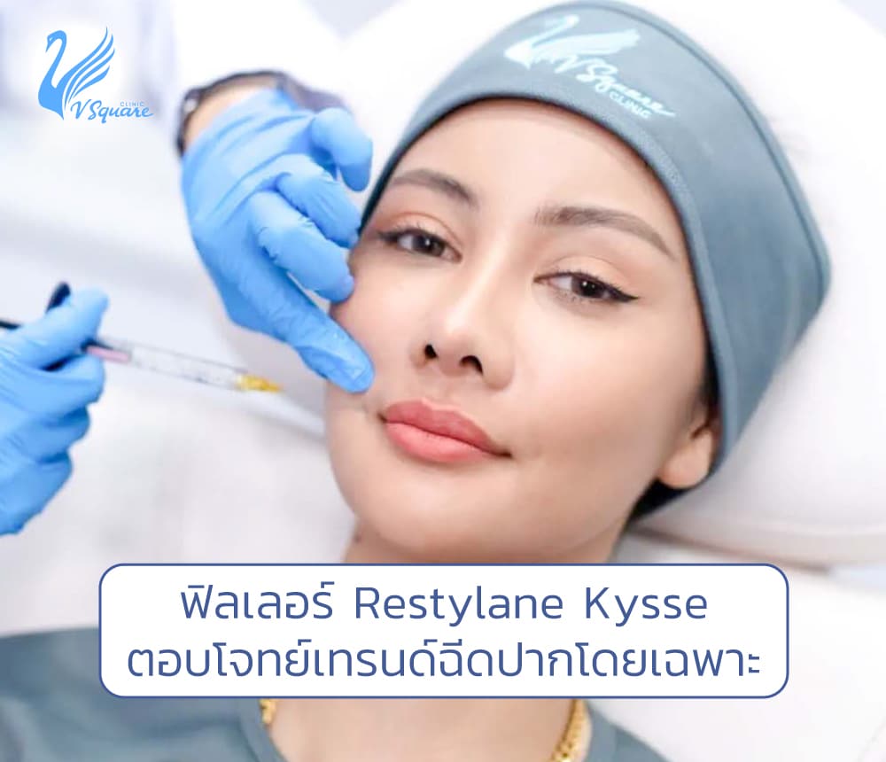 ฟิลเลอร์ Restylane Kysse