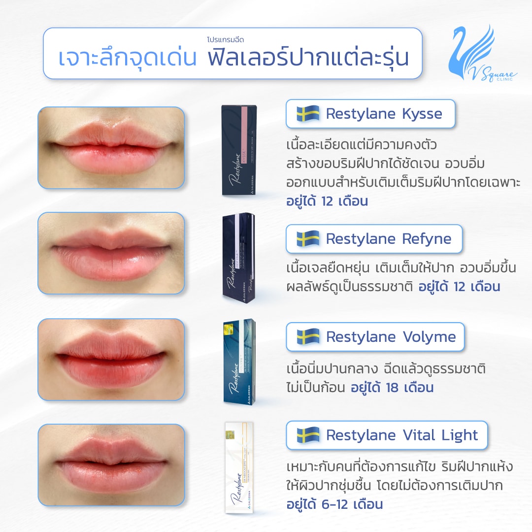 ฟิลเลอร์ปากยี่ห้อ Restylane