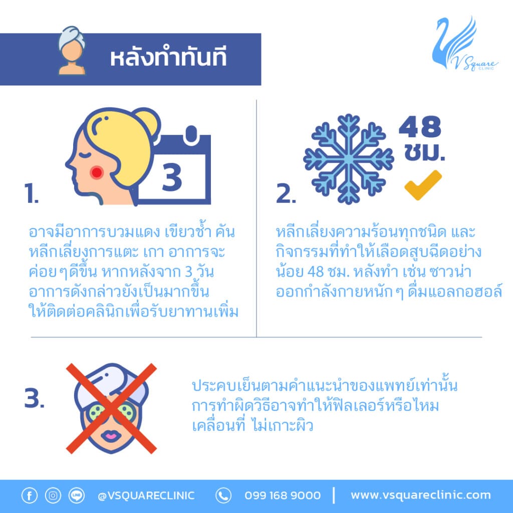 หลังฉีดฟิลเลอร์