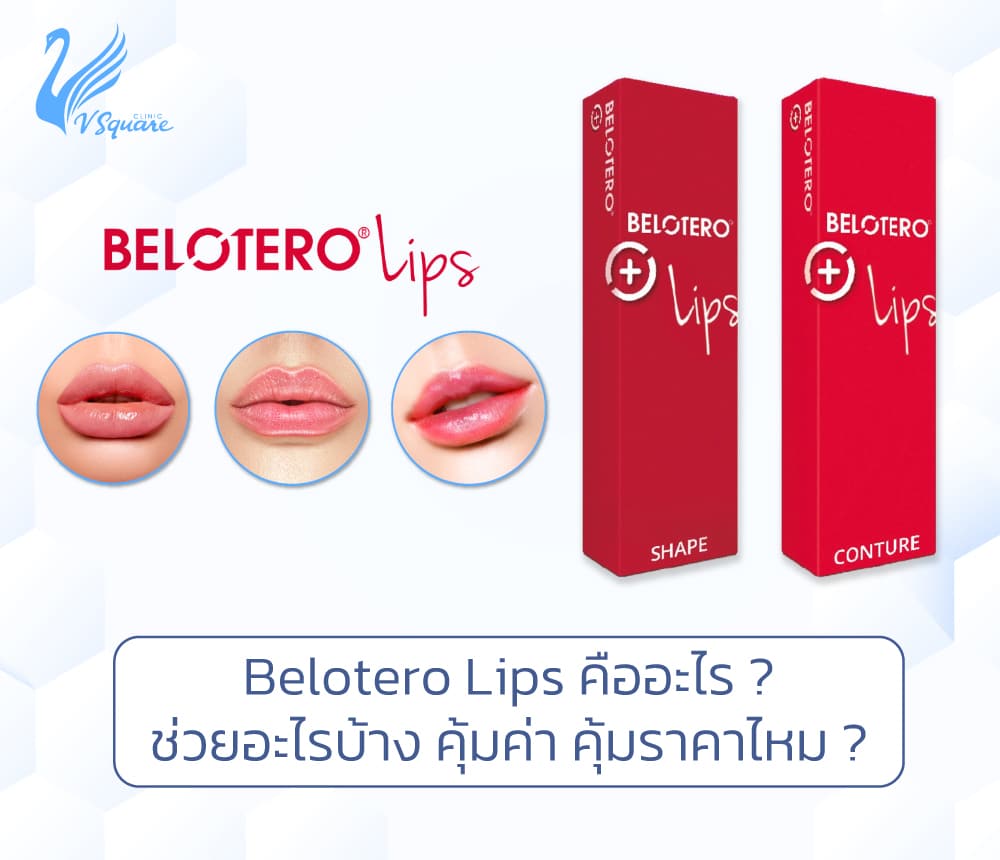 Belotero Lips