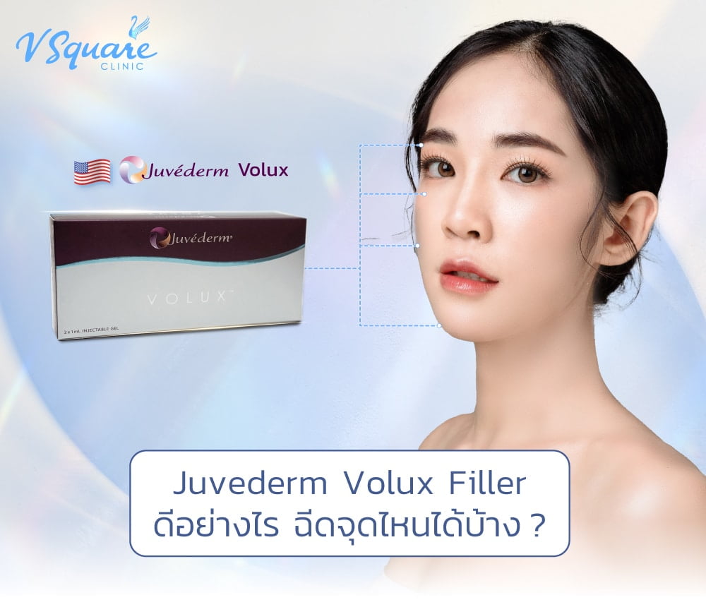 Juvederm Volux