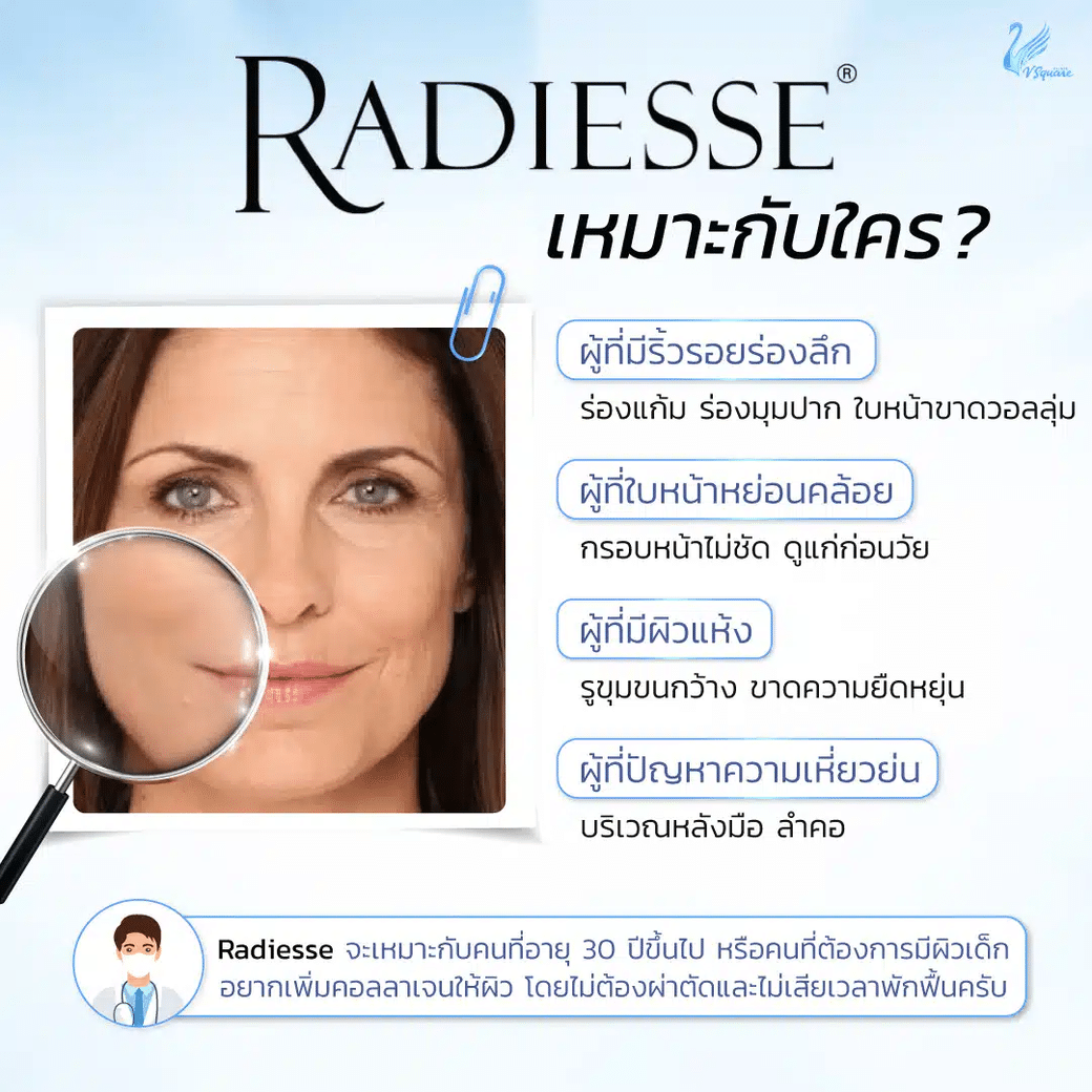 Radiesse Filler เหมาะกับ