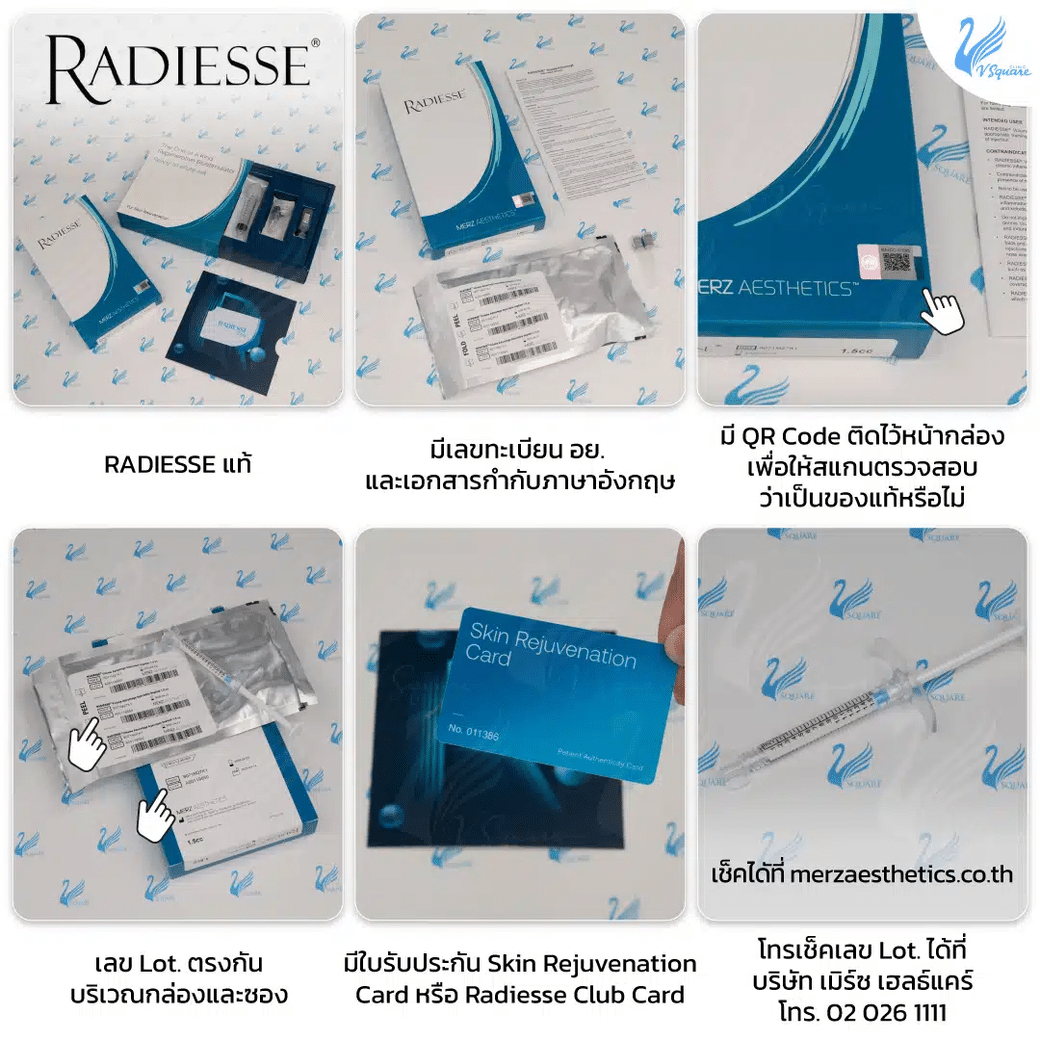 Radiesse ของแท้