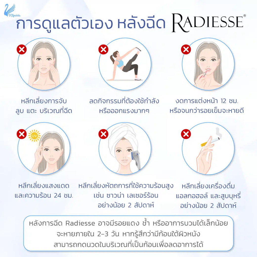 การดูแลหลังฉีด Radiesse Filler