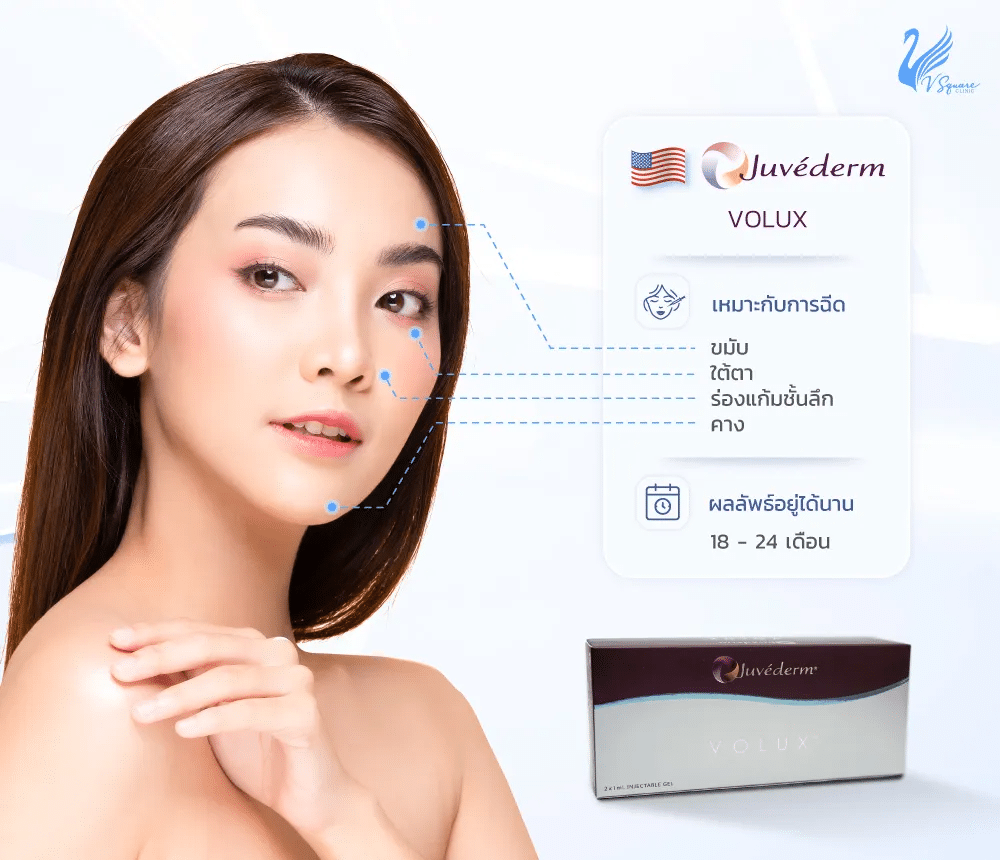 ตำแหน่งฉีด Juvederm Volux