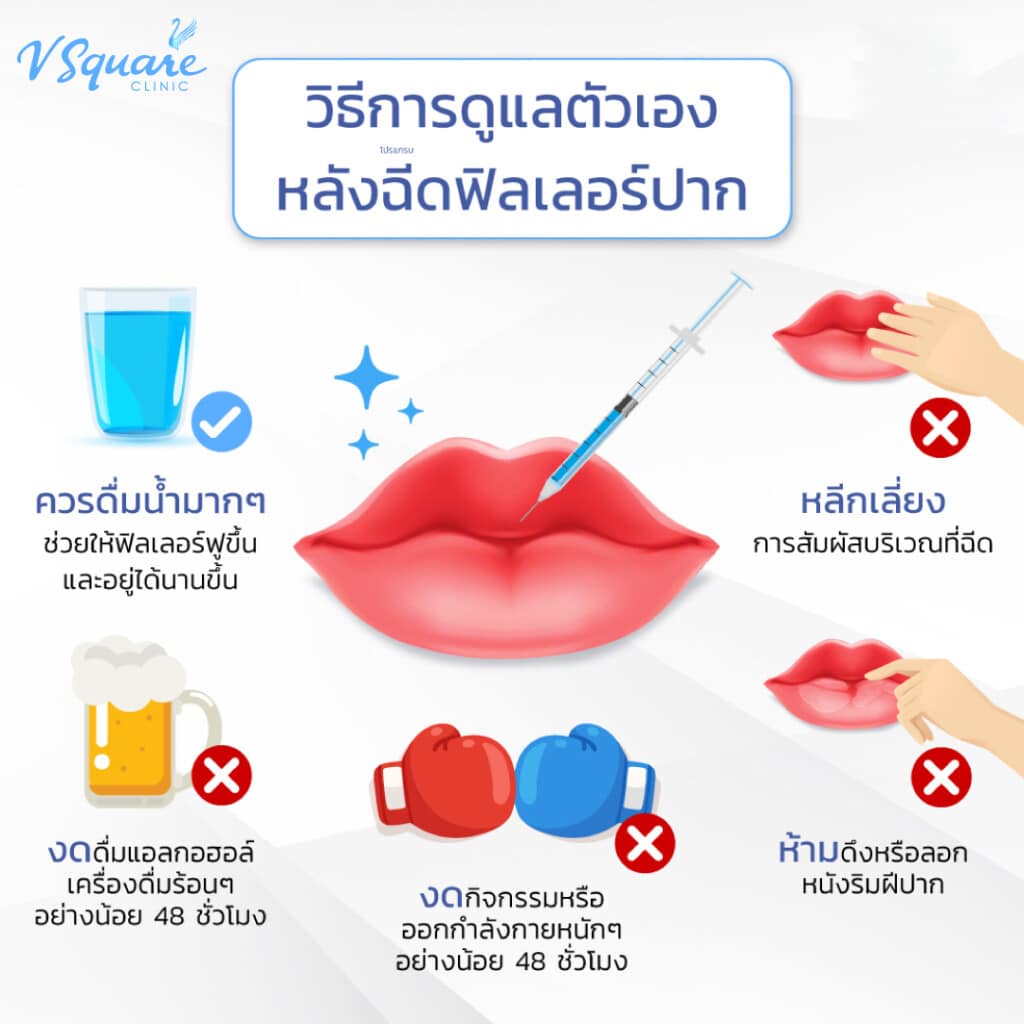 หลังฉีดฟิลเลอร์