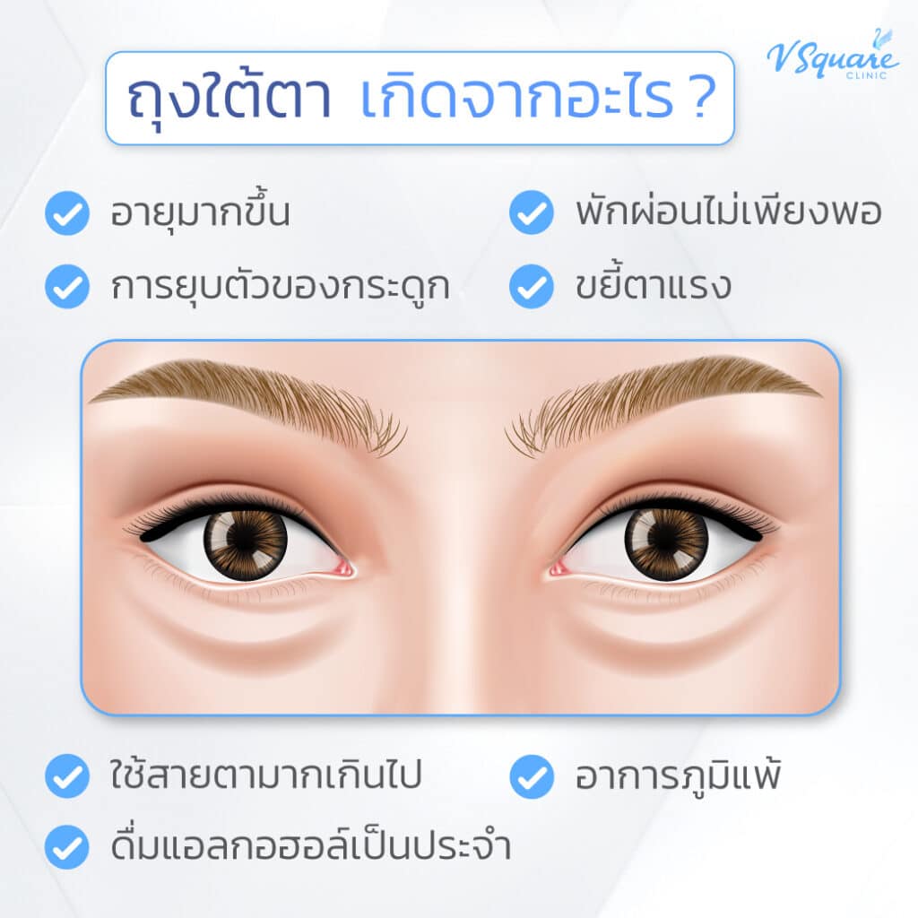 สาเหตุถุงใต้ตา