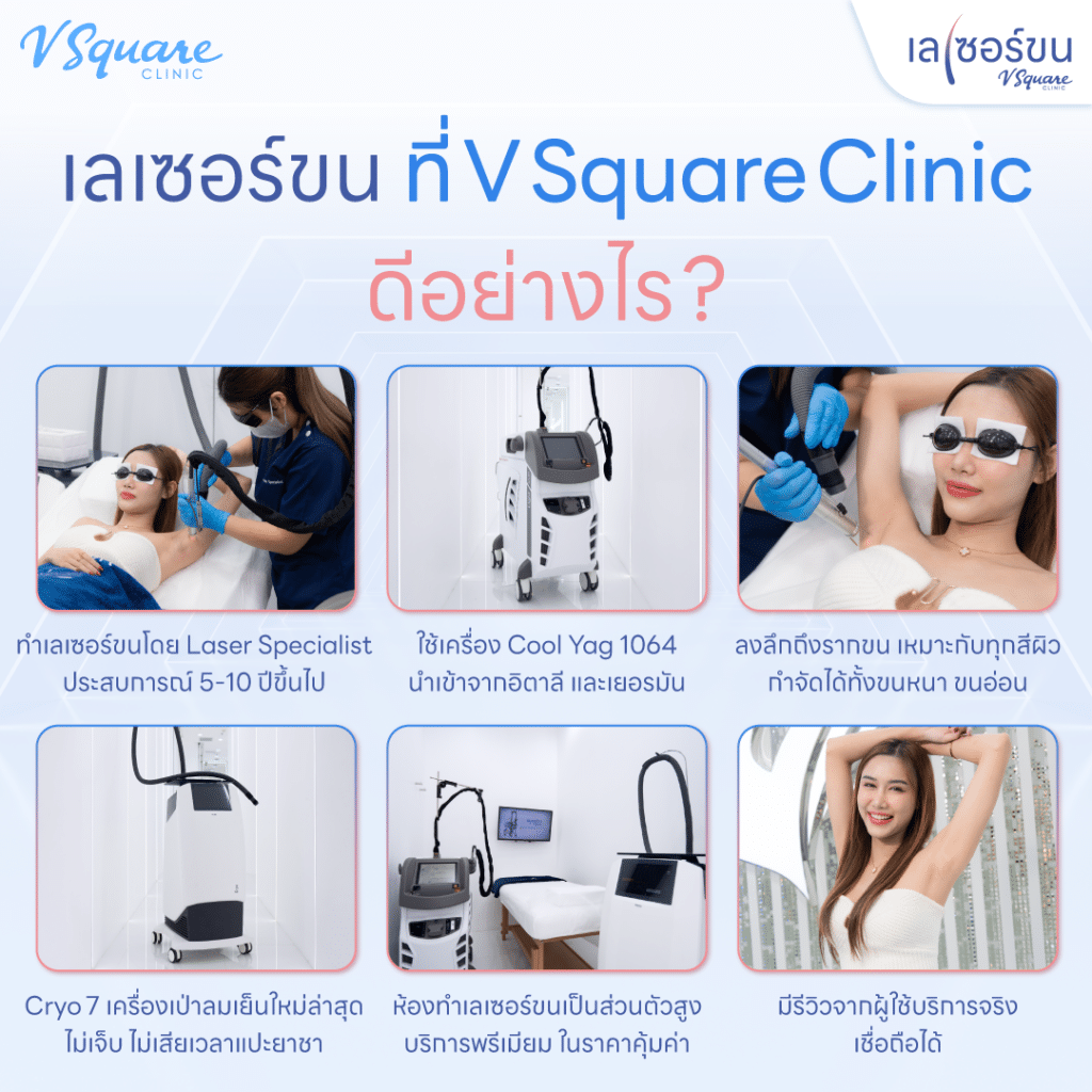 เลเซอร์ขนที่ V Square Clinic