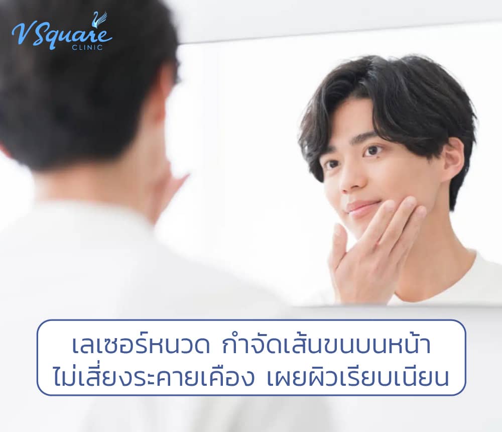 เลเซอร์หนวด