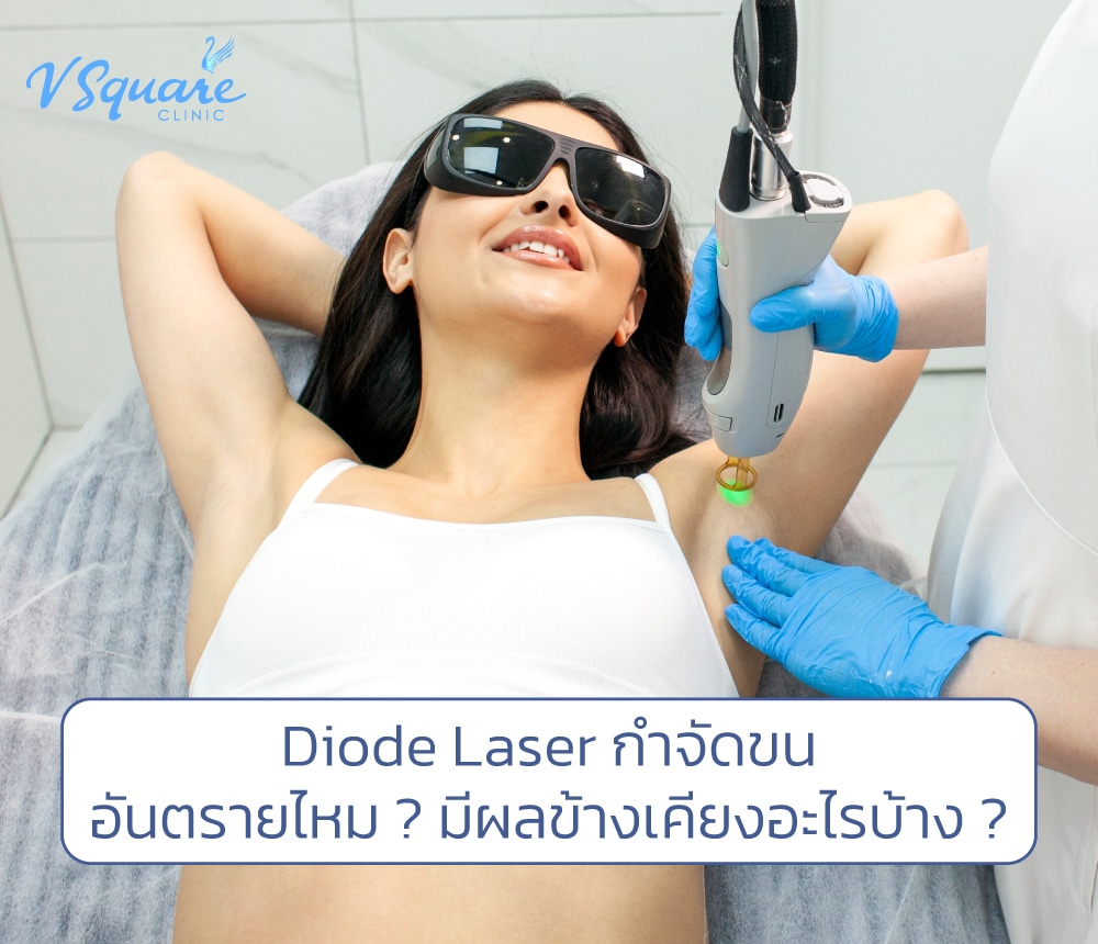 Diode Laser