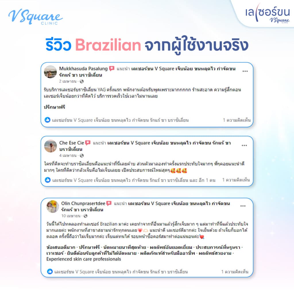 รีวิวเลเซอร์ขน Brazilian