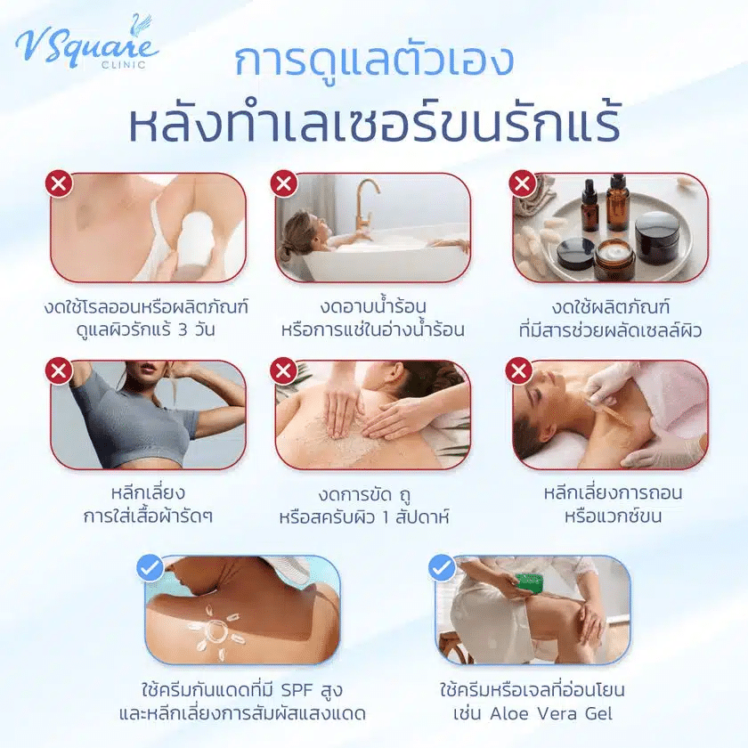 หลังเลเซอร์รักแร้