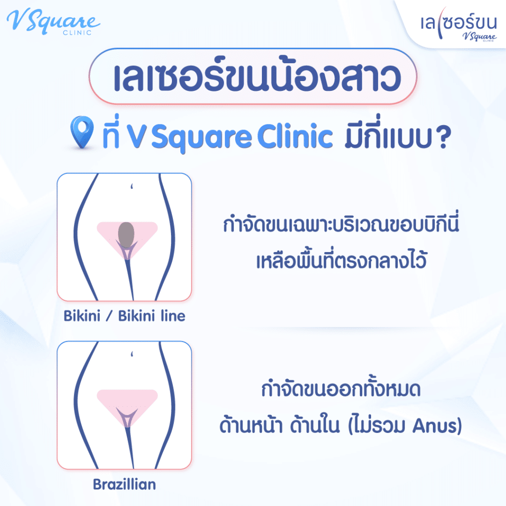 เลเซอร์ขนจิมิราคาต่างกันตามขนาดพื้นที่