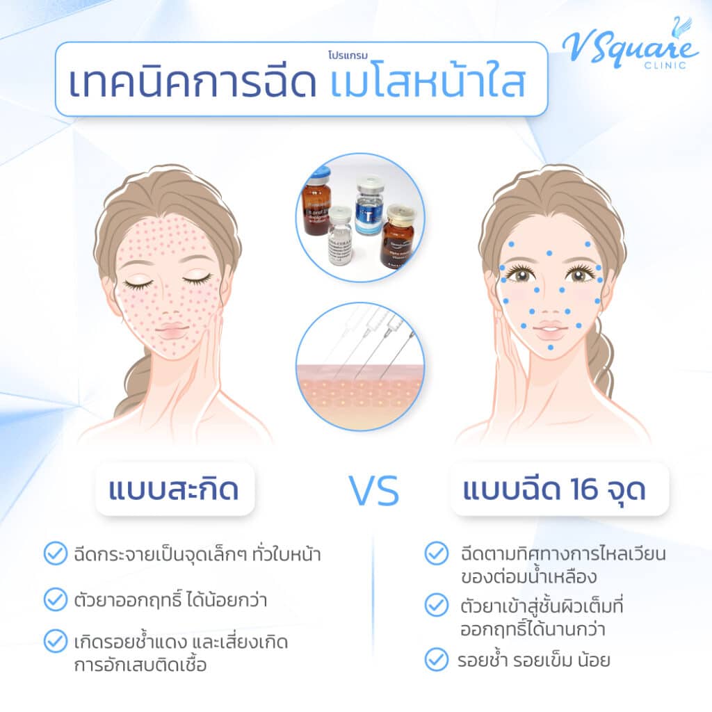 ฉีดเมโสหน้าใส vs สะกิดหน้าใส