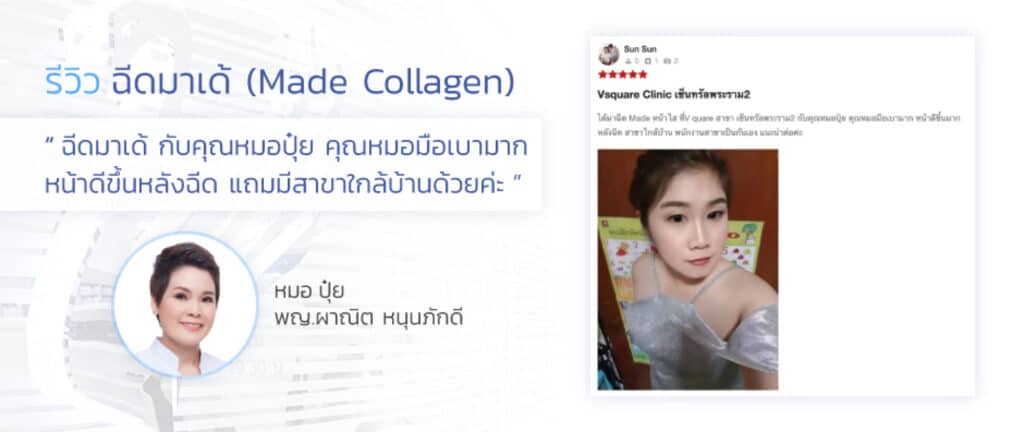 รีวิวเมโสหน้าใส v square clinic