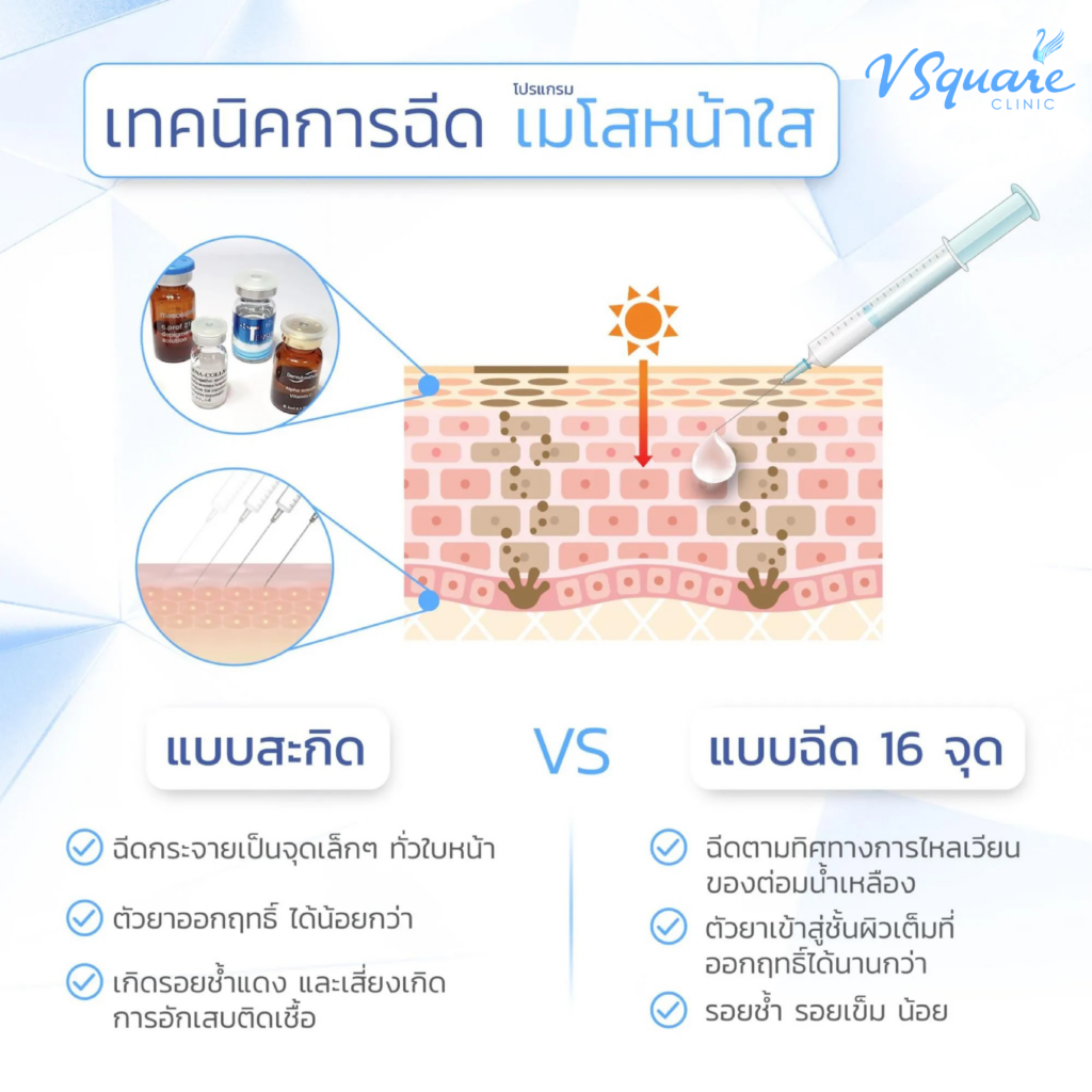 เมโสสะกิด vs เมโสหน้าใส 16 จุด