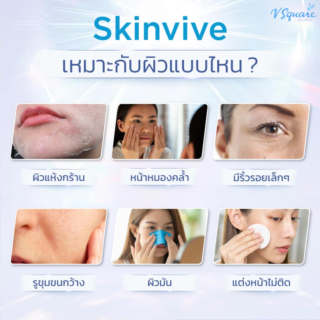 skinvive เหมาะกับ(1)