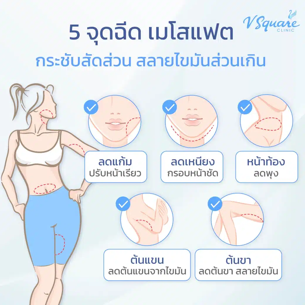 5 จุดฉีดแฟต