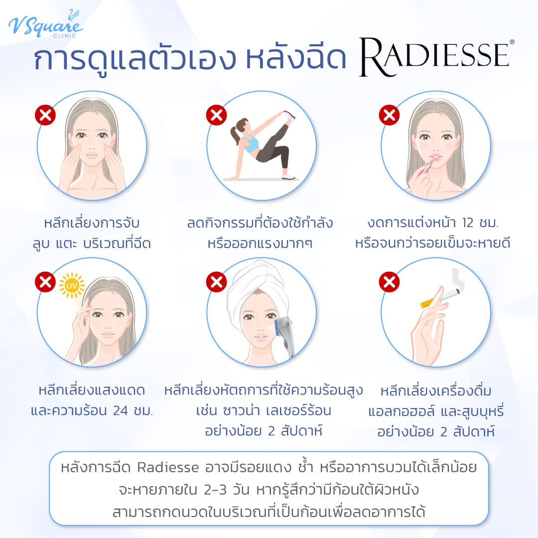 วิธีดูแลตัวเองหลังฉีด Radiesse