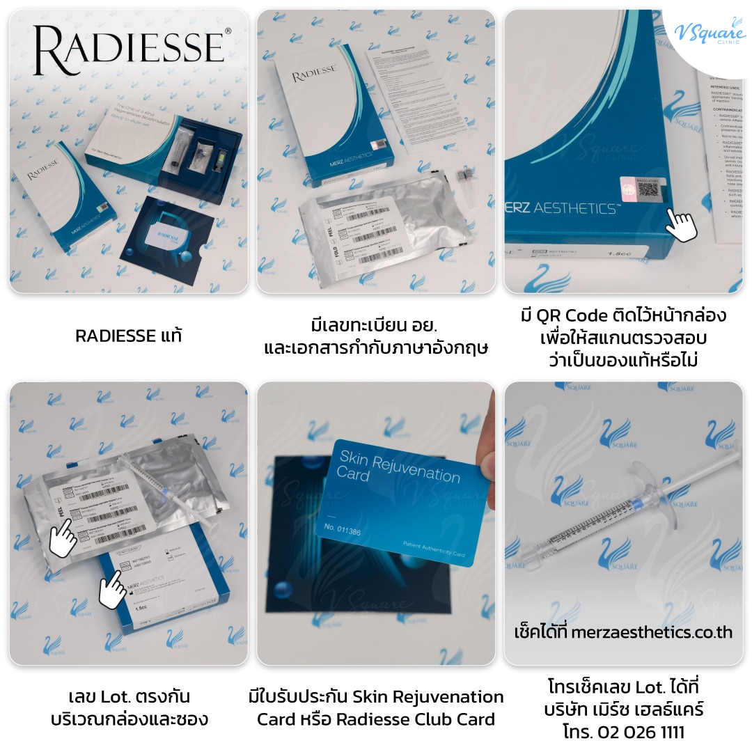 วิธีเช็ก Radiesse Filler ของแท้