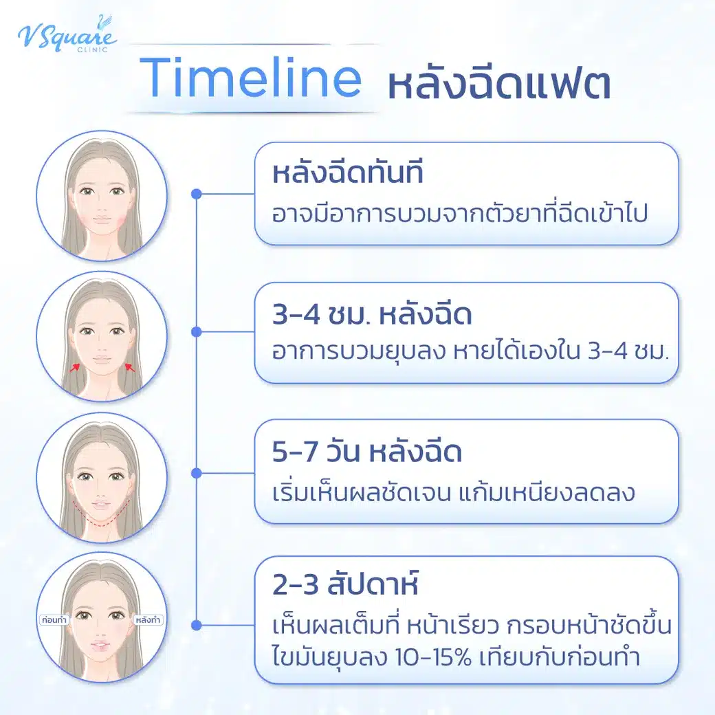 เมโสแฟต กี่วันเห็นผล