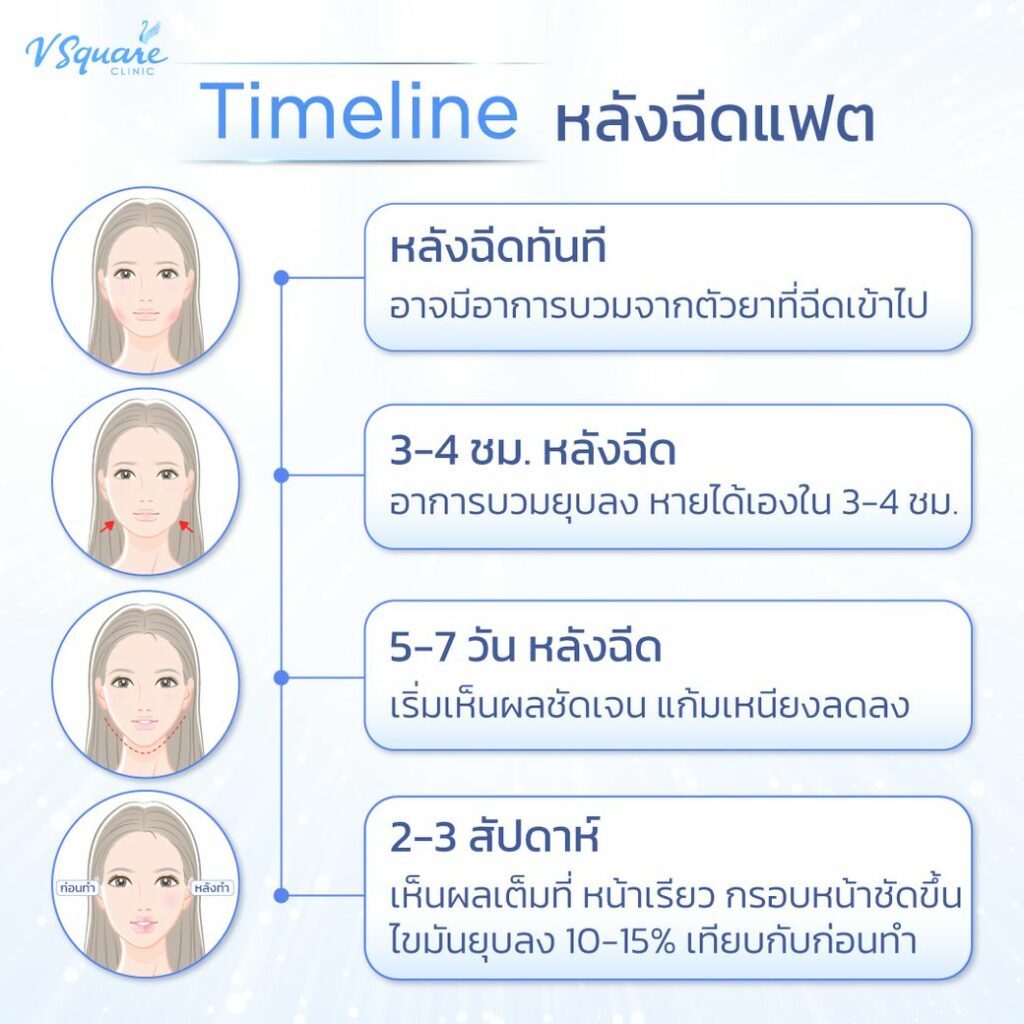 ฉีดเมโสแฟตแล้วหน้าบวม