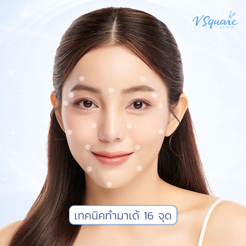 16 จุดมาเด้