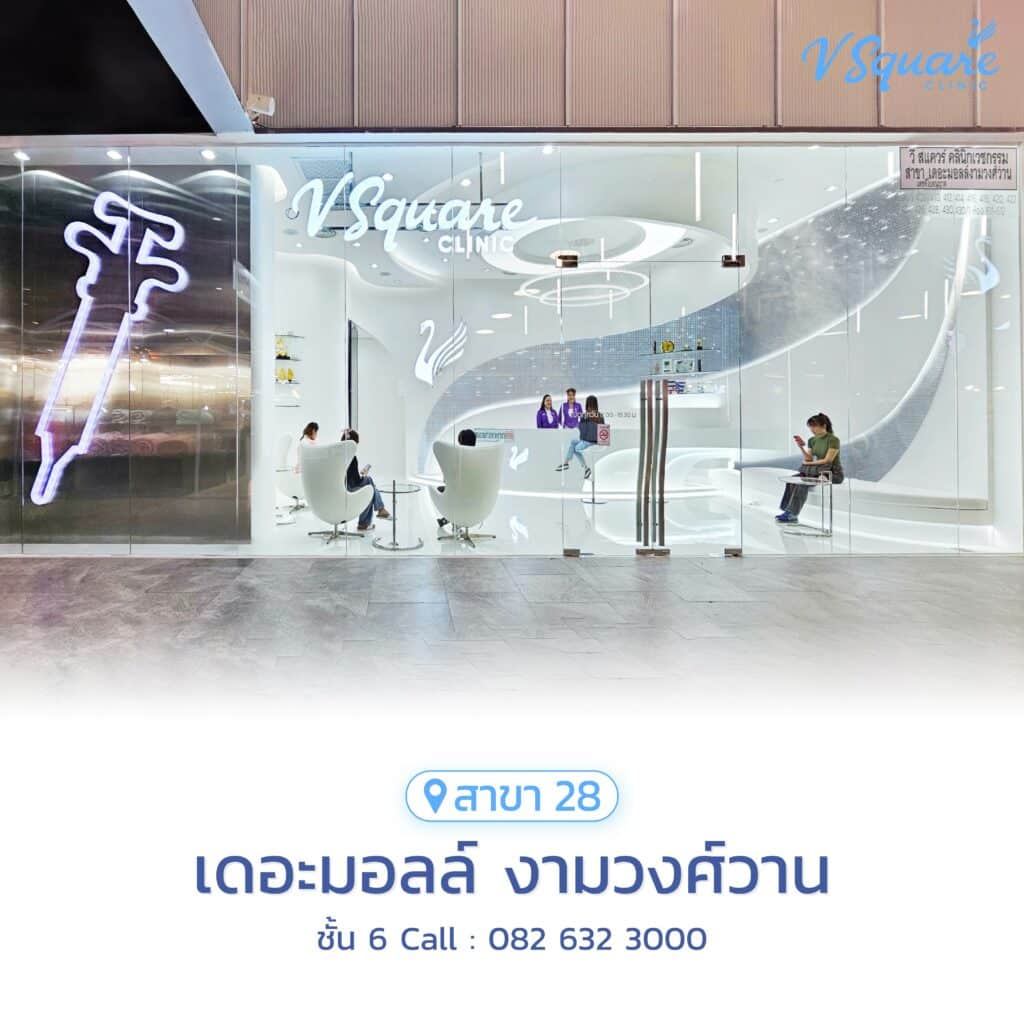 V Square Clinic สาขางามวงศ์วาน