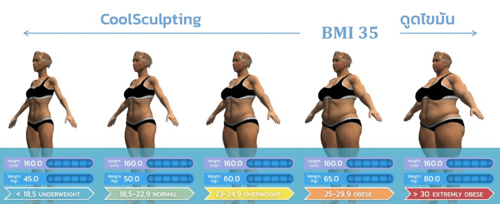 CoolSculpting เหมาะกับใคร