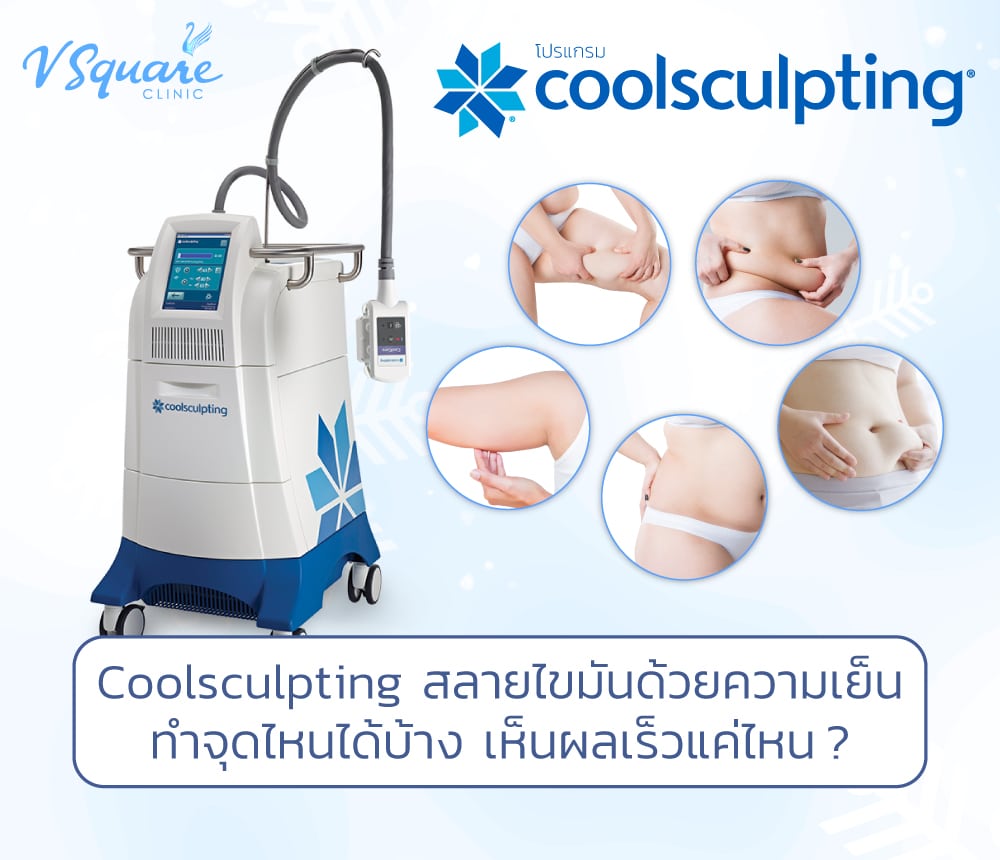 Coolsculpting